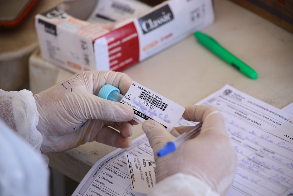 Pesquisa feita pela prefeitura mostra caso de reinfecção pelo coronavírus 2 TESTE PCR DRIVE THRU ENIO MEDEIROS 13 SITE 4 1