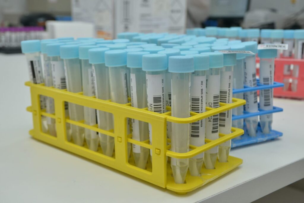 Aparecida de Goiânia é a primeira cidade do Centro-Oeste brasileiro a identificar duas novas variantes da Ômicron. Resultado foi identificado graças ao sequenciamento genômico realizado na cidade 