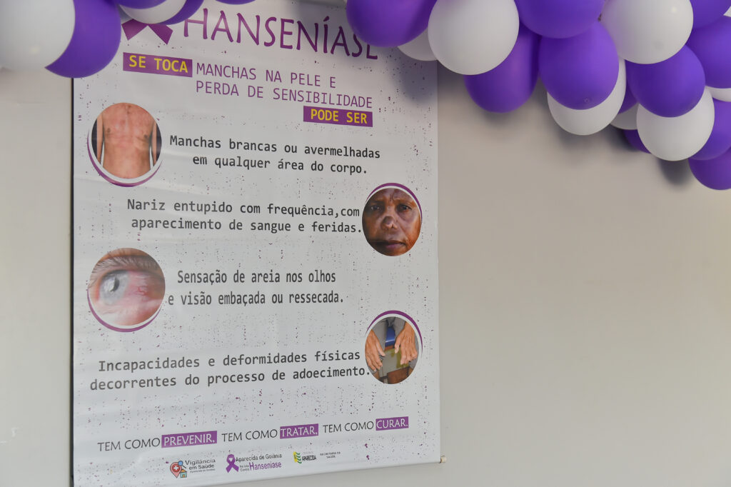 Janeiro Roxo tem diagnóstico e prevenção da Hanseníase como temas