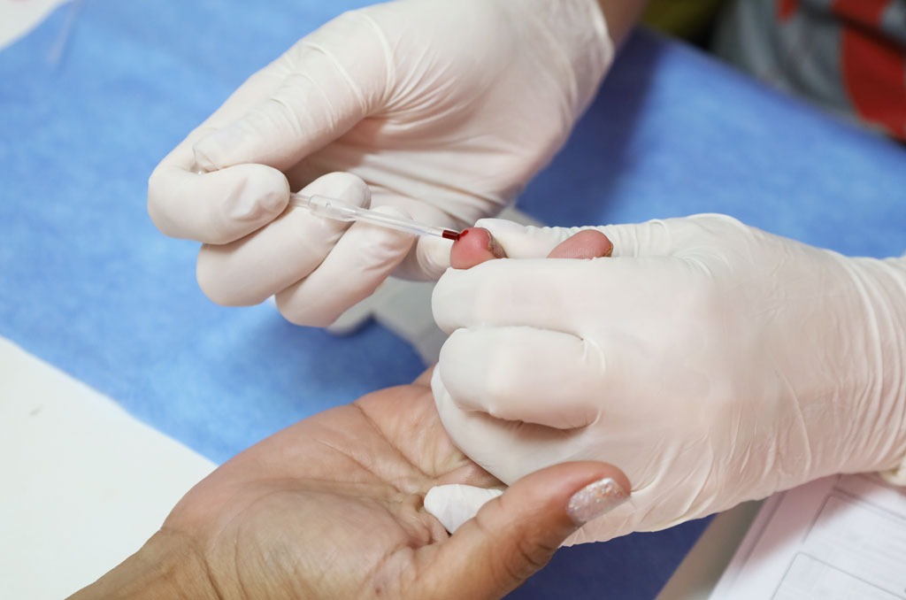 Saúde intensifica a testagem e prevenção às doenças sexualmente transmissíveis em Aparecida 5 Aparecida de Goiânia